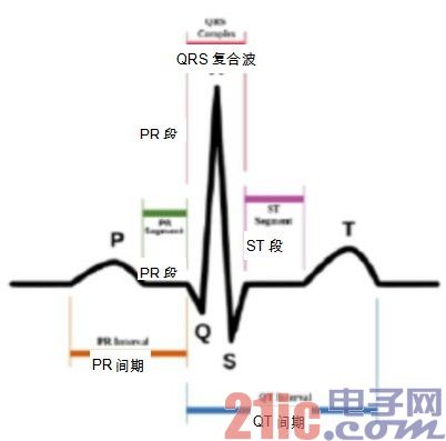 图一：心电图中的 P-QRS-T波.jpg