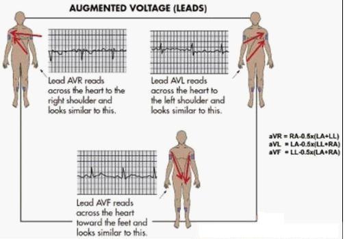 利用ECG AFE简化病人监护仪设计