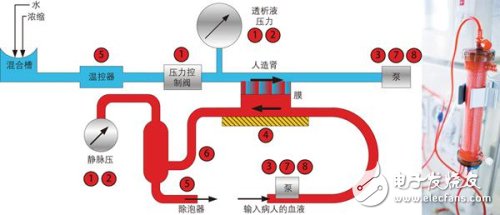 血液透析机要求极其精确地测量患者血压和透析液(清除血流中的毒素)压力